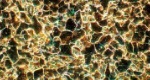 Mikrogefüge mit ferritischen Körnern
