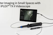 Better Imaging in Small Spaces with the IPLEX™ TX II Videoscope